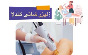 لیزر شاتی کندلادراسلامشهر + سیستم کولینگ بدون درد